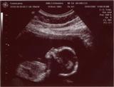 Baby Profile